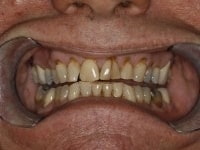 Konig Center for Cosmetic & Comprehensive Dentistry smile photos